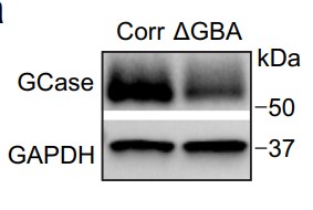 Western blot analysis of PD patient-derived mutant GBA1 dopaminergic neurons.jpg